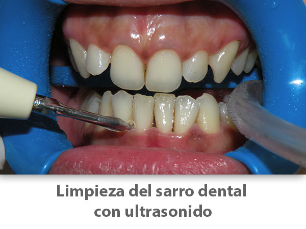 Periodoncia